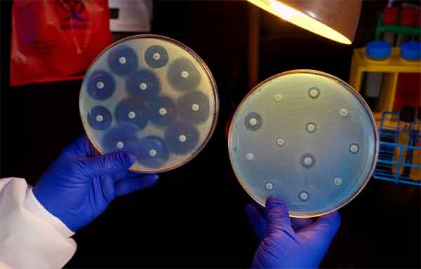 Resistência antimicrobiana a antibióticos